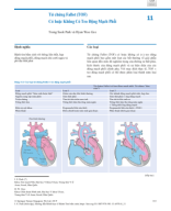 11.Tứ chứng Fallot (TOF) có hoặc không có hẹp phổi_Biên dịch Bs Nguyễn Chí Phồn.pdf