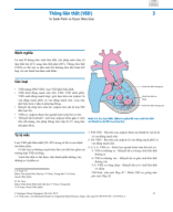 3. Thông liên thất ( Ventricular Septal Defect (VSD)_Biên dịch Bs Nguyễn Chí Phồn.pdf