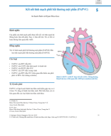 5. Kết Nối Tĩnh Mạch Phổi Bất Thường Một Phần (Partial Anomalous Pulmonary Venous Connection - PAPVC)_Biên dịch Bs Nguyễn Chí Phồn.pdf