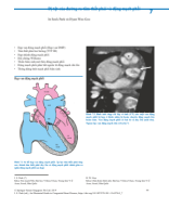 7.Các Bất Thường của Đường Ra Tâm Thất Phải và Động Mạch Phổi(Abnormalities of the Right Ventricular )_Biên dịch Bs Nguyễn Chí Phồn.pdf