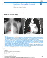 28. Hình ảnh đa dạng trong bệnh tim bẩm sinh Biên dịch Bs Nguyễn Chí Phồn.pdf