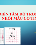 ECG TRONG NMCT .pptx