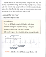 9 ngoại tâm thu.pdf