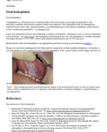 Topic _ Therapeutic Guidelines Oral leukoplakia.pdf