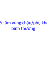 1. Sieu am phu khoa binh thuong.pdf