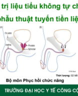 Bài 4. VLTL Sàn chậu sau PT tuyến tiền liệt 2025.pdf