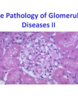 The Pathology of Glomerular Diseases-Nephritic.pdf