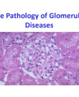 The Pathology of Glomerular Diseases-Nephrotic.pdf