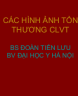 HA các tổn thương clvt ngực - Bs Lưu.ppt