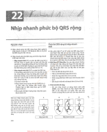 22. NHỊP NHANH PHỨC BỘ QRS RỘNG.pdf