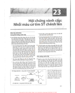 23. HỘI CHỨNG VÀNH CẤP - NHỒI MÁY CƠ TIM ST CHÊNH LÊN.pdf