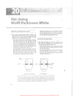 20. HỘI CHỨNG WOLFF-PARKINSON-WHITE.pdf