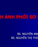 BS Linh - Hinh anh phoi so sinh.pdf