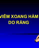 Viem xoang do rang.PPT