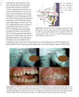 Chỉnh nha lâm sàng Từ nguyên lý đến kỹ thuật p3.pdf