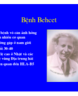 Benh behcetsr.pdf