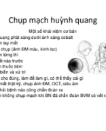 Chup mach huynh quang.pdf