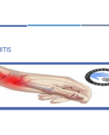 TEMA 53 - TENDINITIS.pdf