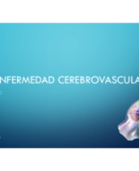 TEMA 55 - ENFERMEDAD CEREBROVASCULAR.pdf