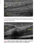 thực hành siêu âm cơ xương khớp p2.pdf