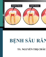 BỆNH SÂU RĂNG sửa.pptx