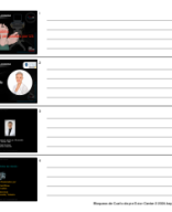 Bloqueos de Cuello de pie Dolor Center 2 2024.pdf