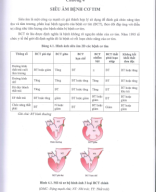 chương 4 siêu âm bệnh cơ tim.pdf