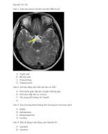 Nội Tiết Y21 CK.docx