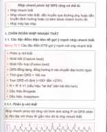 12 nhịp nhanh thất.pdf