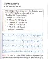 10 nhịp nhanh trên thất xuất phát từ nhĩ.pdf