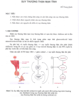 suy thượng thận mạn tính.pdf